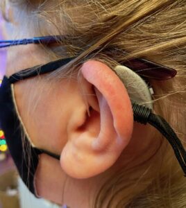 Editors Blog &#8211; Adding AI drives the hearing aid market, Weartech Design