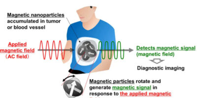Magnetic sensor is basis for image diagnosis technology